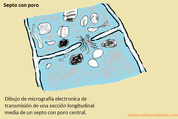 septo con poro (79K)